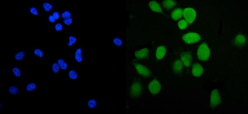 PLTP Rabbit Polyclonal Antibody