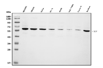 PLTP Rabbit Polyclonal Antibody