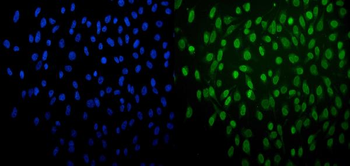 PRDM14 Rabbit Polyclonal Antibody