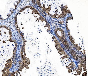PRDM14 Rabbit Polyclonal Antibody