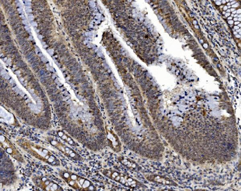 PRDM14 Rabbit Polyclonal Antibody