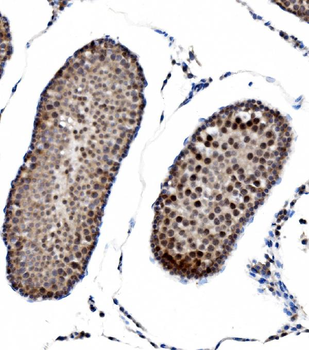 PRDM14 Rabbit Polyclonal Antibody