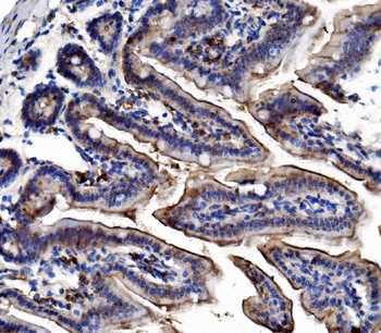 TRIM16 Rabbit Polyclonal Antibody