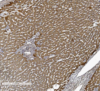 ALK-1/ACVRL1 Antibody