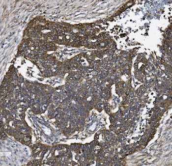 ALK-1/ACVRL1 Antibody