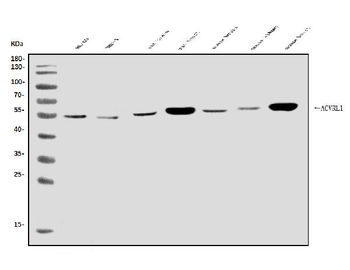 ALK-1/ACVRL1 Antibody