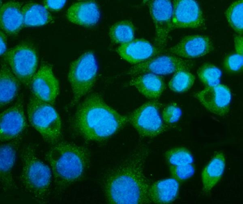 CGAS Rabbit Polyclonal Antibody