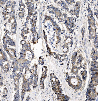 CHCHD10 Rabbit Polyclonal Antibody