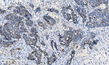CHCHD10 Rabbit Polyclonal Antibody