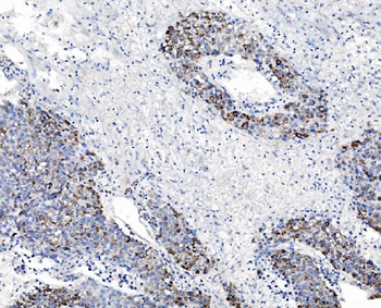 CHCHD10 Rabbit Polyclonal Antibody
