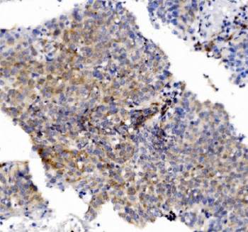CHCHD10 Rabbit Polyclonal Antibody