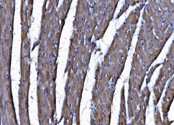 CHCHD10 Rabbit Polyclonal Antibody