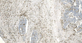 Coronin 1a/TACO/CORO1A Antibody