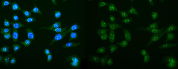 DCTN1/p150-glued Rabbit Polyclonal Antibody