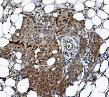 DCTN1/p150-glued Rabbit Polyclonal Antibody