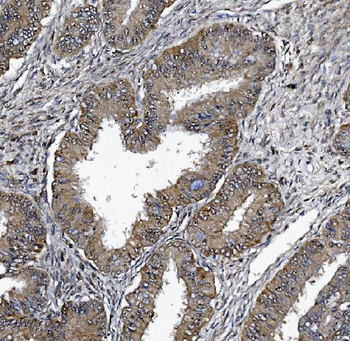 DCTN1/p150-glued Rabbit Polyclonal Antibody