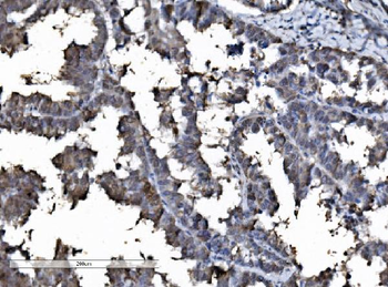 DYNLL1/PIN Rabbit Polyclonal Antibody