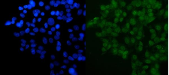 DYNLL1/PIN Rabbit Polyclonal Antibody