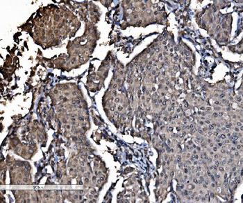 DYNLL1/PIN Rabbit Polyclonal Antibody