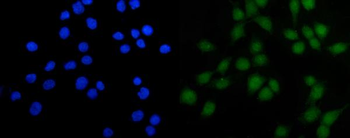 FOXJ1 Rabbit Polyclonal Antibody