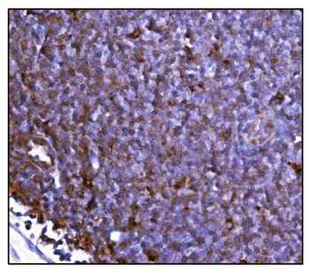 FABP-1/GOT2 Antibody