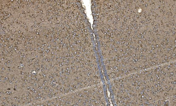 FABP-1/GOT2 Antibody