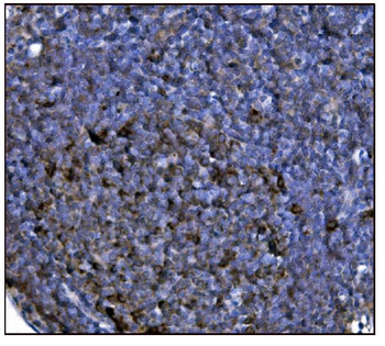 FABP-1/GOT2 Antibody