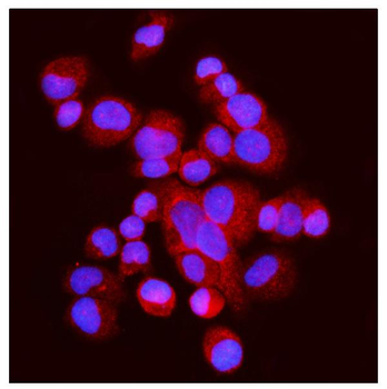 FABP-1/GOT2 Antibody