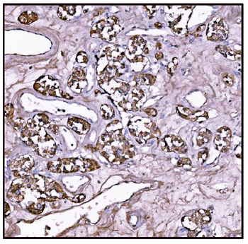 FABP-1/GOT2 Antibody