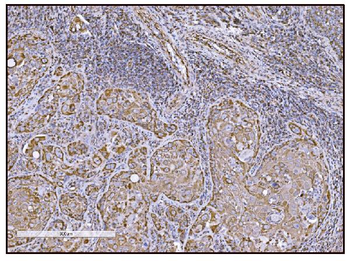 FABP-1/GOT2 Antibody