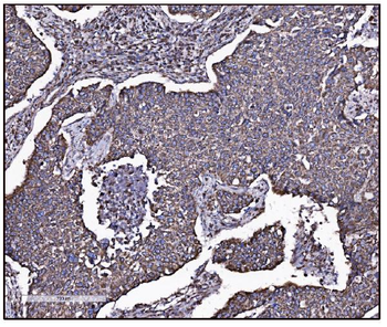 FABP-1/GOT2 Antibody