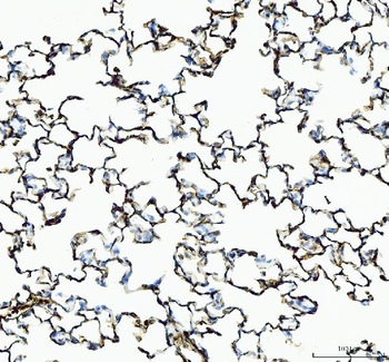 IL1RA/Il1rn Antibody