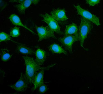 MIEF1 Rabbit Polyclonal Antibody
