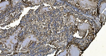 MIEF1 Rabbit Polyclonal Antibody