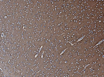 NSF Rabbit Polyclonal Antibody