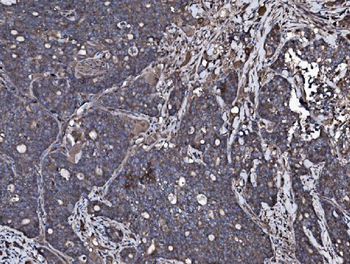 NSF Rabbit Polyclonal Antibody