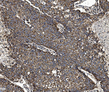 NSF Rabbit Polyclonal Antibody
