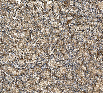 NSF Rabbit Polyclonal Antibody