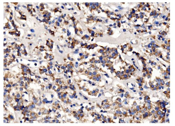 PFKFB2 Antibody