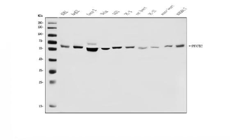 PFKFB2 Antibody