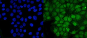 PSMB5/MB1 Rabbit Polyclonal Antibody