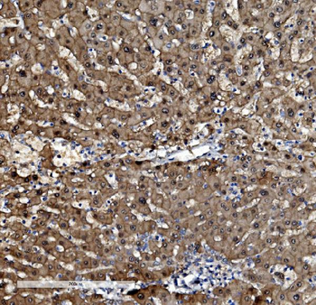 PSMB5/MB1 Rabbit Polyclonal Antibody