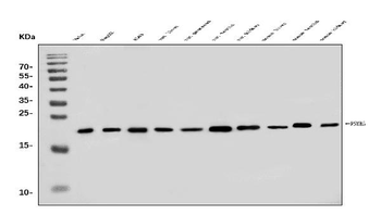 PSMB5/MB1 Rabbit Polyclonal Antibody