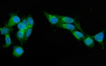 SEC23A Rabbit Polyclonal Antibody