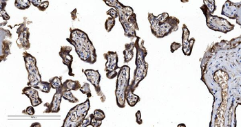 SEC23A Rabbit Polyclonal Antibody