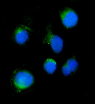 SERINC3 Rabbit Polyclonal Antibody
