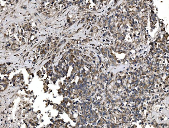 Astrin/Deepest/SPAG5 Rabbit Polyclonal Antibody