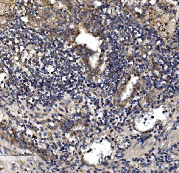 Astrin/Deepest/SPAG5 Rabbit Polyclonal Antibody