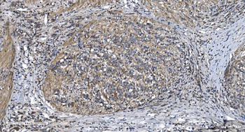 STIL/SIL Rabbit Polyclonal Antibody