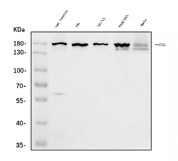 STIL/SIL Rabbit Polyclonal Antibody